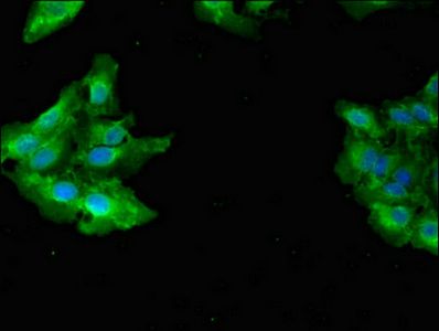 GAB2 Antibody