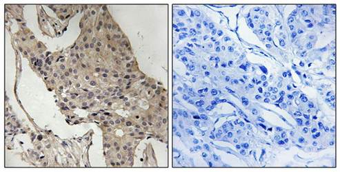 Gab2 (Phospho-Ser623) Antibody