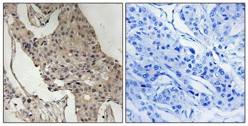 Gab2 (phospho-Ser623) antibody