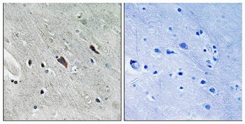 Gab2 (phospho-Tyr643) antibody