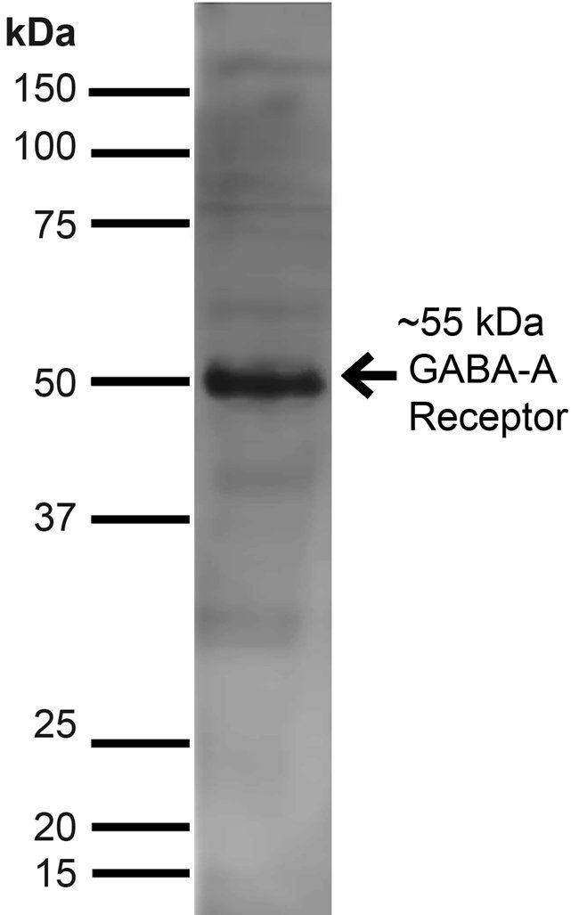 GABA A Receptor Antibody