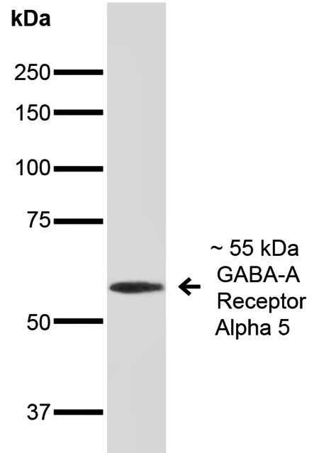 GABA A Receptor Antibody