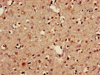 GABARAPL1 Antibody