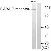 GABBR1 antibody