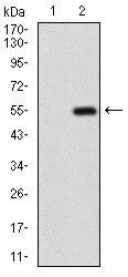 GABBR2 Antibody