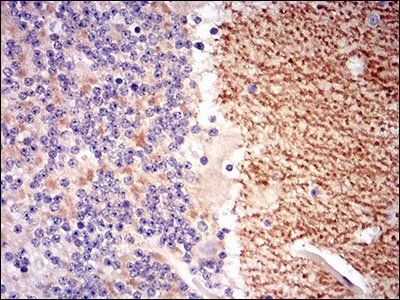 GABBR2 Antibody