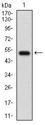 GABBR2 Antibody