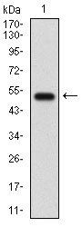 GABBR2 Antibody