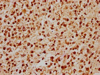 GABPA Antibody
