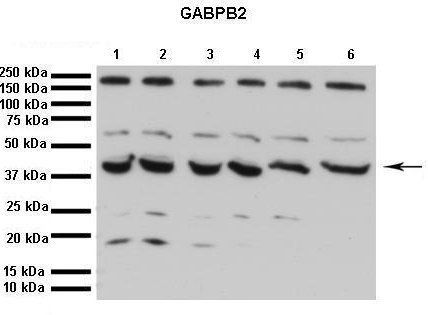 GABPB1 antibody