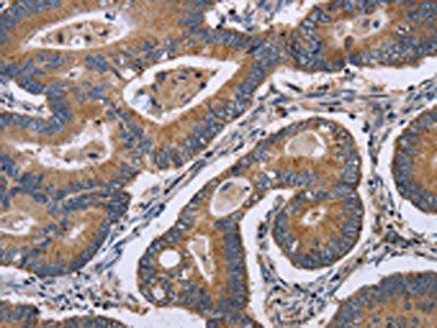 GABPB2 antibody