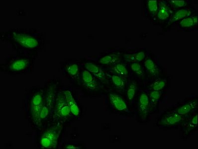 GABPB2 antibody