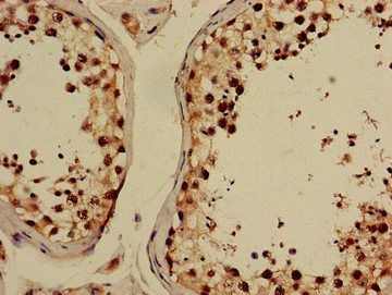 GABPB2 antibody