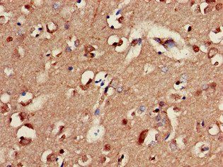 GABRA2 Antibody