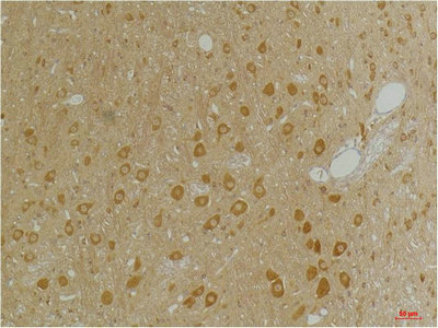 GABRA3 Antibody