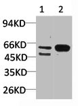 GABRA3 antibody