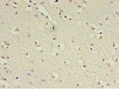 GABRA4 Antibody
