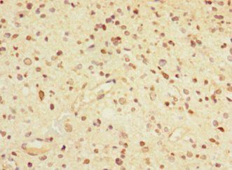 GABRA5 Antibody