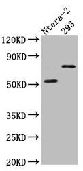 GABRA5 Recombinant Monoclonal Antibody