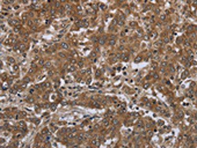 GABRB1 Antibody
