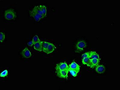 GABRB2 antibody