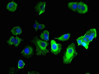 GABRQ antibody