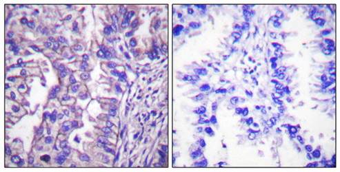 GAD1/2 Antibody