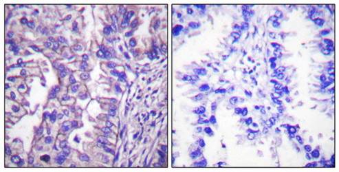 GAD1/2 antibody