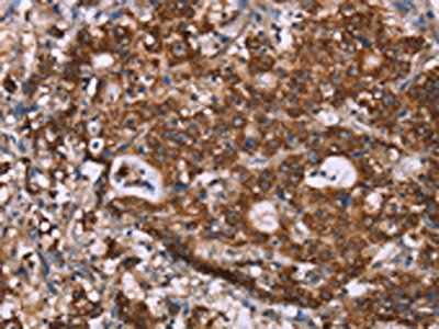 GAD1 Antibody