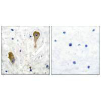 GAD1 Antibody