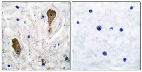 GAD1 Antibody