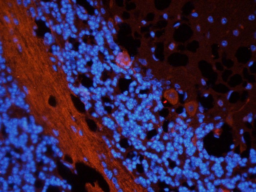Gad1 antibody