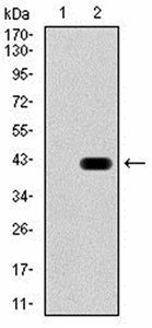 GAD2 Antibody