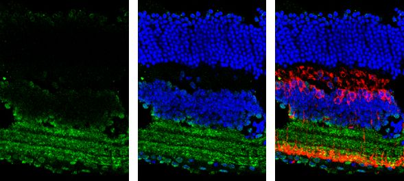 GAD65 antibody [C2C3], C-term