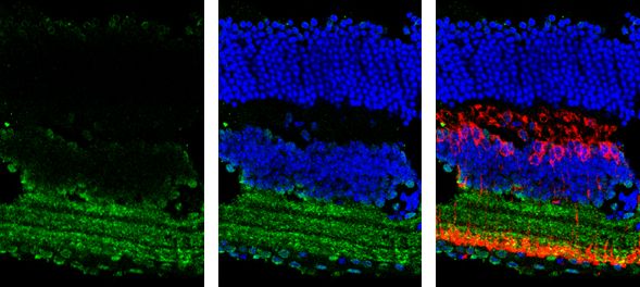 GAD65 antibody