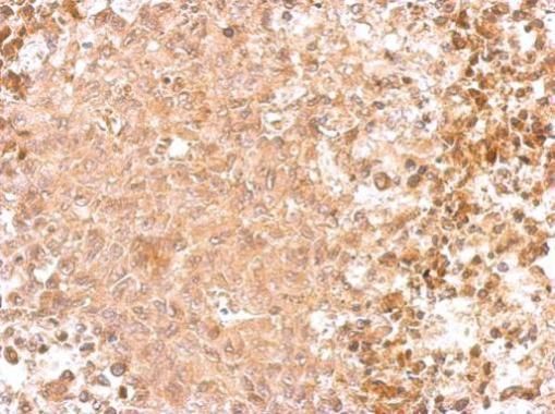 GAD65 antibody [C2C3], C-term