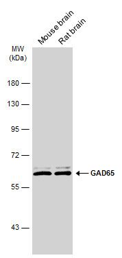 GAD65 antibody