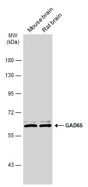 GAD65 antibody [C2C3], C-term