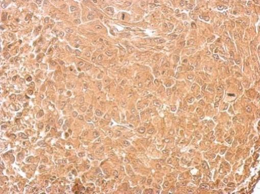 GAD65 antibody
