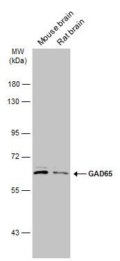 glutamate decarboxylase 2 Antibody