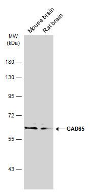GAD65 antibody