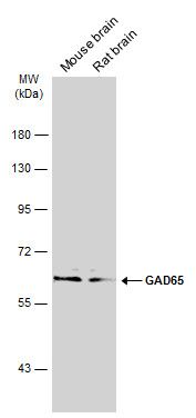 glutamate decarboxylase 2 Antibody