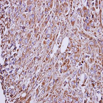 GAD65 antibody