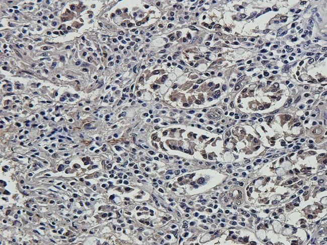 GADD153 antibody