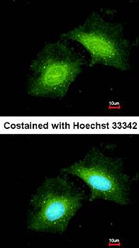 GADD 45 gamma antibody