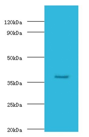 GALT Antibody
