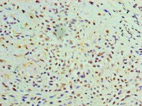 GALE Antibody