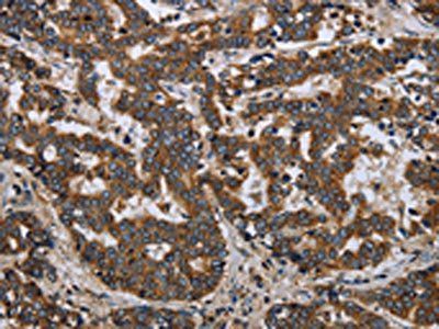 LGALS2 Antibody