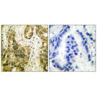 LGALS3 Antibody