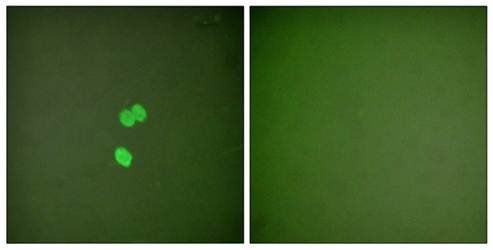 Galectin 3 antibody